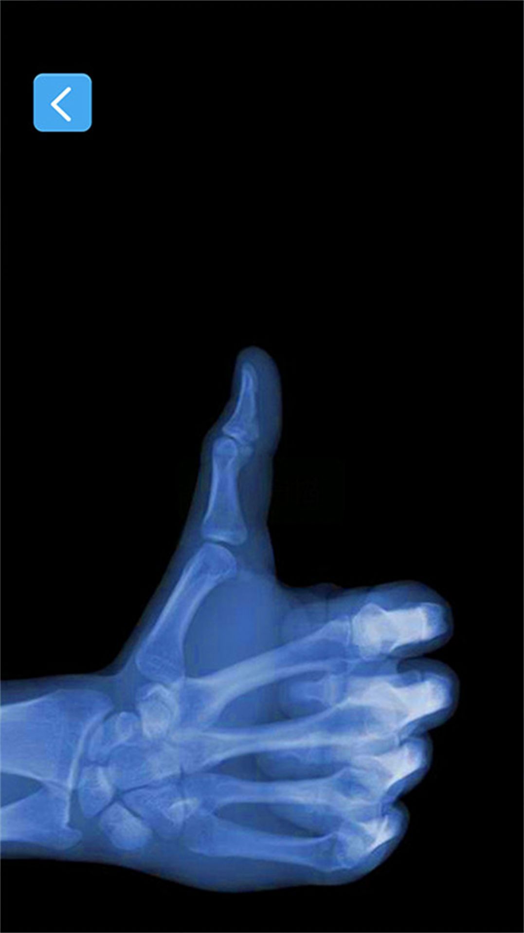 X射线模拟器游戏安卓(2)